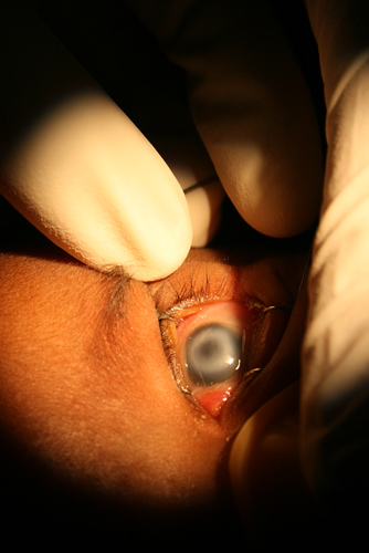 before-surgery